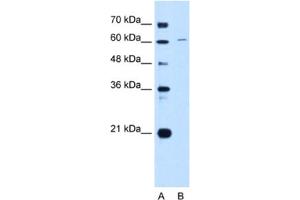 Western Blotting (WB) image for anti-Chromatin Licensing and DNA Replication Factor 1 (CDT1) antibody (ABIN2462973) (CDT1 抗体)