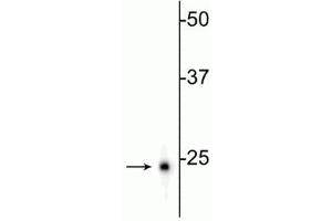 Western blot of rat hippocampal homogenate showing specific immunolabeling of the (UCHL1 抗体)