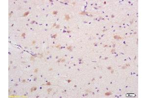 Formalin-fixed and paraffin embedded rat brain labeled with Rabbit Anti DEDD1 Polyclonal Antibody, Unconjugated  at 1:200 followed by conjugation to the secondary antibody and DAB staining (DEDD 抗体  (AA 151-250))