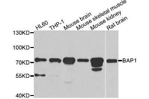 Western blot analysis of extracts of various cell lines, using BAP1 antibody. (BAP1 抗体  (AA 460-729))
