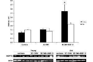 Western Blotting (WB) image for anti-Heat Shock Protein 70 (HSP70) antibody (ABIN361708)