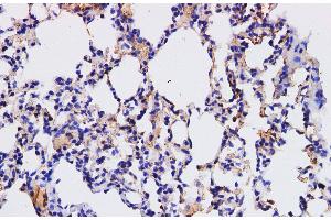 Immunohistochemistry of paraffin-embedded Mouse lung using HPGD Polyclonal Antibody at dilution of 1:200 (HPGD 抗体)