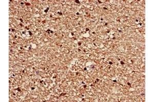 Immunohistochemistry of paraffin-embedded human brain tissue using ABIN7175571 at dilution of 1:100 (CACNG3 抗体  (AA 235-315))