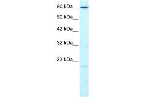WB Suggested Anti-LIG4 Antibody Titration:  1. (LIG4 抗体  (N-Term))