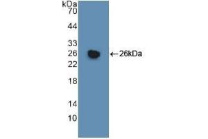 Detection of Recombinant GSTm1, Human using Polyclonal Antibody to Glutathione S Transferase Mu 1 (GSTM1) (GSTM1 抗体  (AA 1-218))