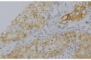 ABIN6277563 at 1/100 staining Human uterus tissue by IHC-P. (CFP 抗体  (Internal Region))
