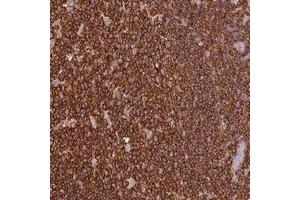 Immunohistochemical staining of human tonsil with OR6P1 polyclonal antibody  shows strong cytoplasmic positivity in germinal and non-germinal center cells at 1:20-1:50 dilution. (OR6P1 抗体)