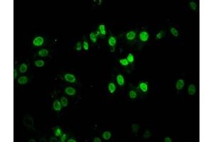 Immunofluorescence (IF) image for anti-Dapper, Antagonist of beta-Catenin, Homolog 1 (DACT1) (AA 410-525) antibody (ABIN7149488)