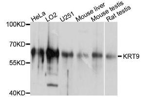 Western blot analysis of extracts of various cell lines, using KRT9 antibody. (KRT9 抗体  (AA 150-450))