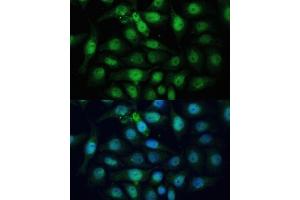 Immunofluorescence (IF) image for anti-ZW10 Interactor (ZWINT) (AA 1-277) antibody (ABIN6150552)