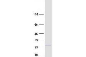 Western Blotting (WB) image for MYC Associated Factor X (MAX) (Transcript Variant 2) protein (Myc-DYKDDDDK Tag) (ABIN2725570)