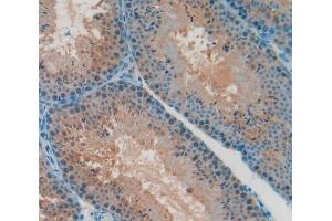 Immunohistochemistry (IHC) image for anti-Interleukin 1 alpha (IL1A) (AA 101-270) antibody (ABIN1862753)