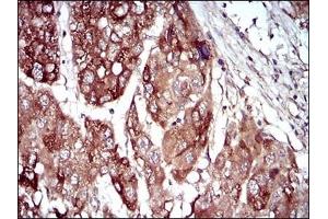 anti-Mitogen-Activated Protein Kinase Kinase 5 (MAP2K5) (AA 63-180) antibody