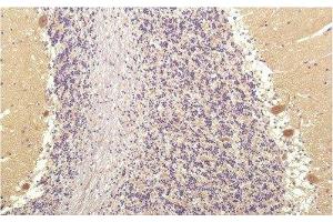 Immunohistochemistry of paraffin-embedded Human brain tissue using SGK1 Monoclonal Antibody at dilution of 1:200. (SGK1 抗体)