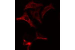ABIN6274865 staining Hela cells by IF/ICC. (Arylsulfatase A 抗体  (Internal Region))