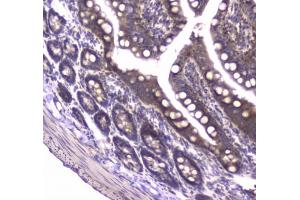 IHC testing of FFPE rat small intestine tissue with MVP antibody at 1ug/ml. (MVP 抗体)