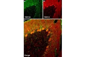 Multiplex staining of TRPC6 and TRPC3 in rat cerebellumImmunohistochemical staining of rat cerebellum frozen section using Guinea pig Anti-TRPC6 Antibody (ABIN7043826, ABIN7045362 and ABIN7045363) and rabbit Anti-TRPC3 Antibody (ABIN7043820, ABIN7043966 and ABIN7043967).