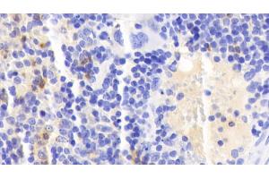 Detection of CAMP in Mouse Spleen Tissue using Polyclonal Antibody to Cathelicidin Antimicrobial Peptide (CAMP) (Cathelicidin 抗体  (AA 31-172))