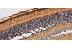 Immunohistochemistry of paraffin-embedded Rat retina using RBP3 Polyclonal Antibody at dilution of 1:50 (RBP3 抗体)