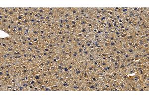 Immunohistochemistry (IHC) image for anti-Toll-Like Receptor Adaptor Molecule 1 (TICAM1) (AA 263-526) antibody (ABIN7441427)