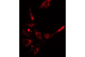 ABIN6266633 staining HepG2 cells by IF/ICC. (INPP5D 抗体  (C-Term))