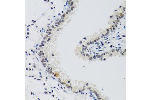 Immunohistochemistry (IHC) image for anti-Cyclin E2 (CCNE2) (C-Term) antibody (ABIN1679046)