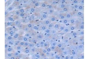 Detection of a2PI in Rat Liver Tissue using Polyclonal Antibody to Alpha 2-Antiplasmin (a2PI) (alpha 2 Antiplasmin 抗体  (AA 348-491))