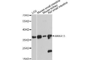 Western blot analysis of extracts of various cell lines, using ANXA13 antibody (ABIN6290067) at 1:3000 dilution. (Annexin A13 抗体)