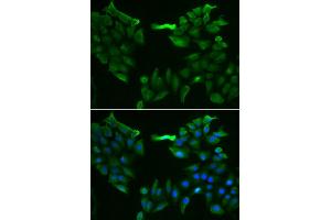 Immunofluorescence analysis of HeLa cell using SLC5A6 antibody.