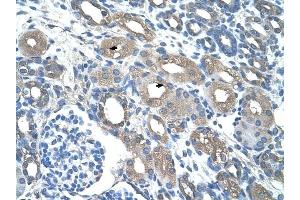 RSAD2 antibody was used for immunohistochemistry at a concentration of 4-8 ug/ml to stain Epithelial cells of renal tubule (arrows) in Human Kidney. (RSAD2 抗体  (C-Term))