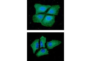 anti-Pyruvate Kinase, Liver and RBC (PKLR) (AA 47-574) antibody