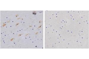 Immunohistochemistry analysis of human brain tissue slide (Paraffin embedded) using Rabbit Anti-GFAP Polyclonal Antibody (Left, ABIN398827) and Purified Rabbit IgG (Whole molecule) Control (Right, ABIN398653) (GFAP 抗体  (AA 250-300))