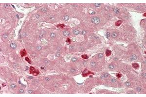 Detection of CHI3L1 in Human Liver Tissue using Polyclonal Antibody to Chitinase-3-like Protein 1 (CHI3L1)