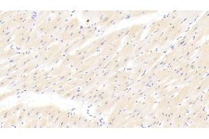 Detection of CRN in Human Cardiac Muscle Tissue using Polyclonal Antibody to Corin (CRN) (Corin 抗体  (AA 807-1038))