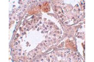 Immunohistochemical staining of human testis tissue with 5 ug/mL C4 or f35 polyclonal antibody . (CABS1 抗体  (C-Term))