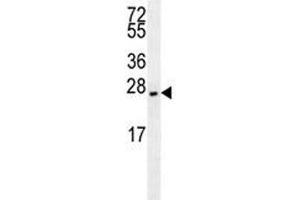 EIF4E2 antibody western blot analysis in NCI-H460 lysate. (EIF4E2 抗体)