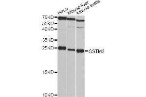 Western blot analysis of extracts of various cell lines, using GSTM3 antibody (ABIN1872914) at 1:3000 dilution. (GSTM3 抗体)