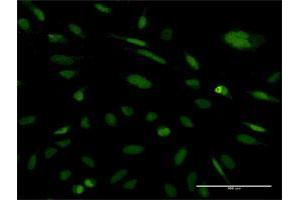 Immunofluorescence of monoclonal antibody to EXOSC5 on HeLa cell. (EXOSC5 抗体  (AA 1-235))