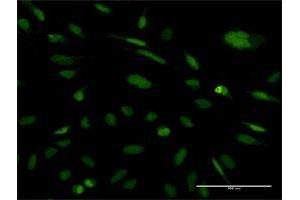 Immunofluorescence of monoclonal antibody to EXOSC5 on HeLa cell.