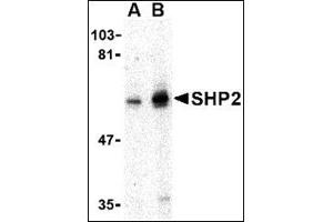 Western blot analysis of SHP2 in mouse skeletal muscle tissue lysate with this product at (A) 0. (PTPN11 抗体  (N-Term))