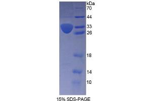 SDS-PAGE analysis of Human KTN1 Protein. (KTN1 蛋白)