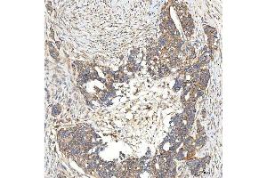 IHC analysis of SNPH using anti-SNPH antibody (ABIN7601724). (Syntaphilin 抗体  (AA 43-482))