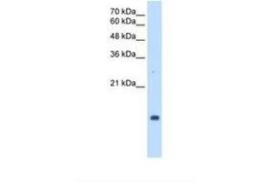 Image no. 2 for anti-Peptidylprolyl Isomerase A (Cyclophilin A) (PPIA) (C-Term) antibody (ABIN321858) (PPIA 抗体  (C-Term))