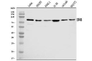Western blot analysis of EIF4B using anti-EIF4B antibody (ABIN7599496).