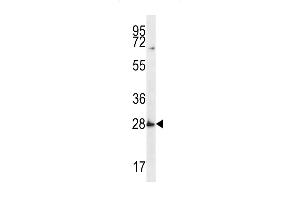 SYPL1 Antibody (N-term) (ABIN656672 and ABIN2845911) western blot analysis in MDA-M cell line lysates (35 μg/lane). (SYPL1 抗体  (N-Term))