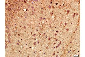 Paraformaldehyde-fixed, paraffin embedded Mouse brain, Antigen retrieval by boiling in sodium citrate buffer (pH6. (CYP46A1 抗体  (AA 51-150))