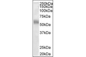 Image no. 1 for anti-Transcription Factor EB (TFEB) (Internal Region) antibody (ABIN374974) (TFEB 抗体  (Internal Region))