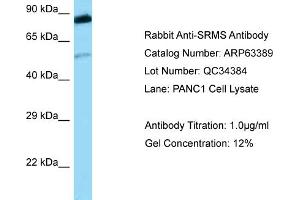 Western Blotting (WB) image for anti-Src-Related Kinase Lacking C-Terminal Regulatory Tyrosine and N-Terminal Myristylation Sites (SRMS) (Middle Region) antibody (ABIN2789479) (SRMS 抗体  (Middle Region))