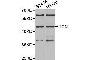 Western blot analysis of extracts of various cell lines, using TCN1 antibody. (TCN1 抗体)