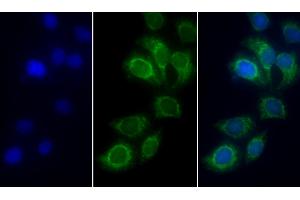 Immunofluorescence (IF) image for anti-Succinate Dehydrogenase Complex, Subunit A, Flavoprotein (Fp) (SDHA) (AA 4-300) antibody (ABIN7441595)